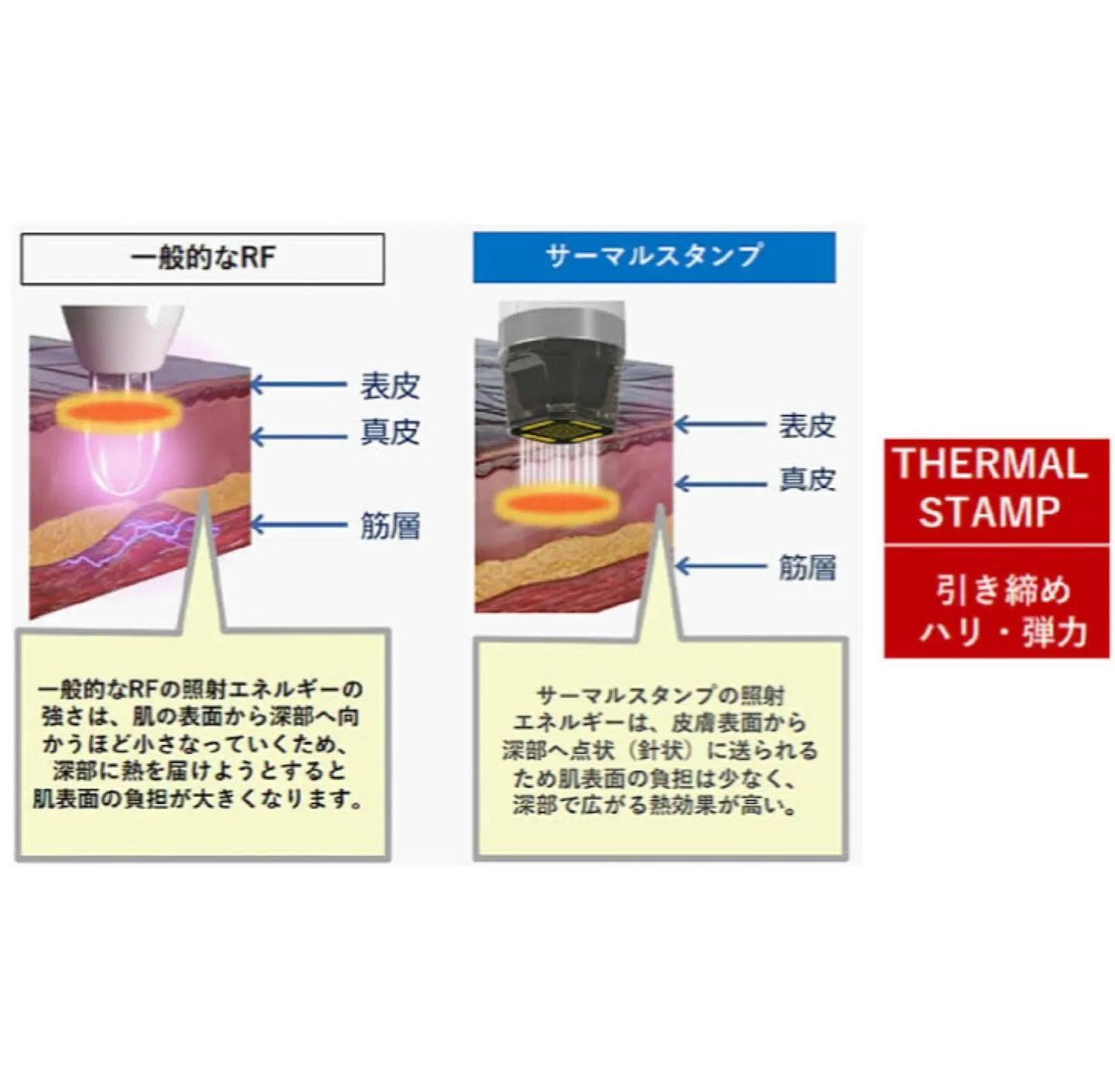 -EMS 小顔フェイシャル-