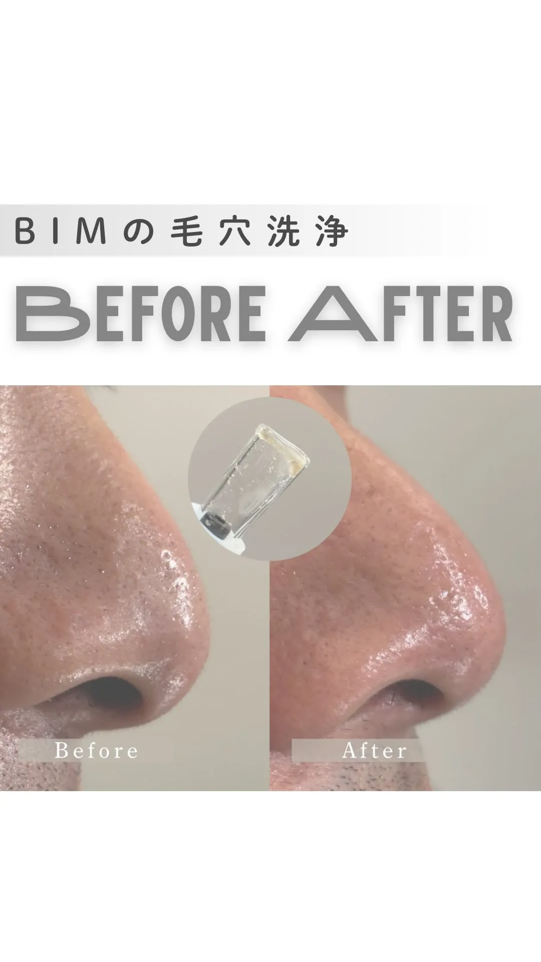 毛穴汚れ、ここまで変わる🤩